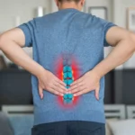 فتق دیسک کمر چیست؟ علل، علائم، درمان و پیشگیری