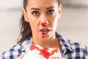 میزان خون از دست رفته بینی در عمل