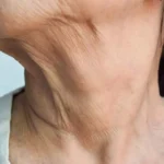 شل شدن پوست را چگونه رفع کنیم؟