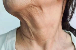 شل شدن پوست را چگونه رفع کنیم؟