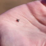 بیماری لایم چیست؟ از نیش کنه تا اثر بر اعصاب و مفاصل