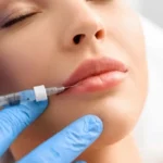 چگونه در 3 روز ورم بعد از تزریق ژل را کاهش دهیم؟