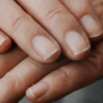 علت پوسته شدن دور ناخن و نحوه خلاص شدن از آن