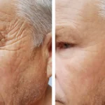 آیا خوردن قند و شکر باعث چروک پوست می‌شود؟