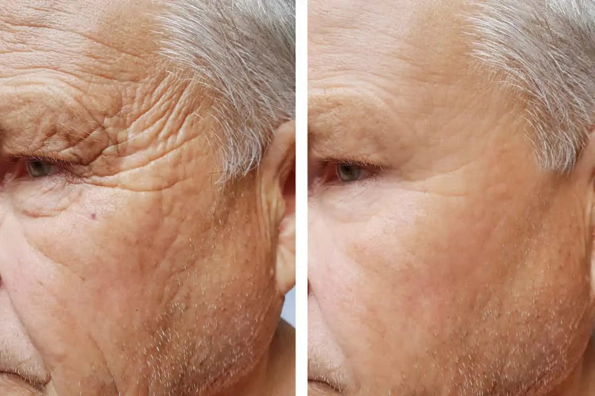 آیا خوردن قند و شکر باعث چروک پوست میشود؟