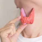 آزمایش TSH؛ نحوه تفسیر و عوامل موثر بر این هورمون تیروئیدی