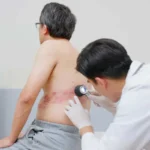 بیماری زونا چیست و چه آسیب‌هایی به بدن وارد می‌کند؟