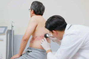 بیماری زونا چیست و چه آسیب‌هایی به بدن وارد می‌کند؟