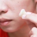 از بین بردن لک صورت با خمیردندان؛ آنچه نمی‌دانید!