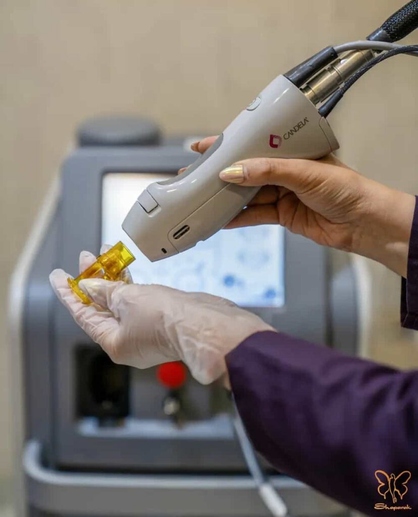 لیزر کندلا مشهد