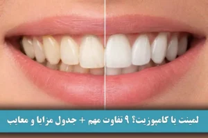 لمینت یا کامپوزیت؟ 9 تفاوت مهم + جدول مزایا و معایب