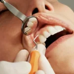 دندانپزشک در حال معاینه دندان‌های بیمار با استفاده از آینه و ابزار دندانپزشکی