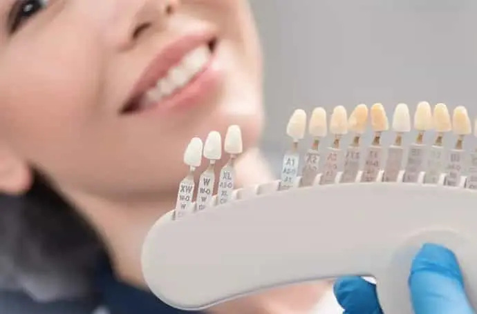 لمینت یا کامپوزیت؟مقایسه کامل مزایا، معایب، قیمت و ماندگاری