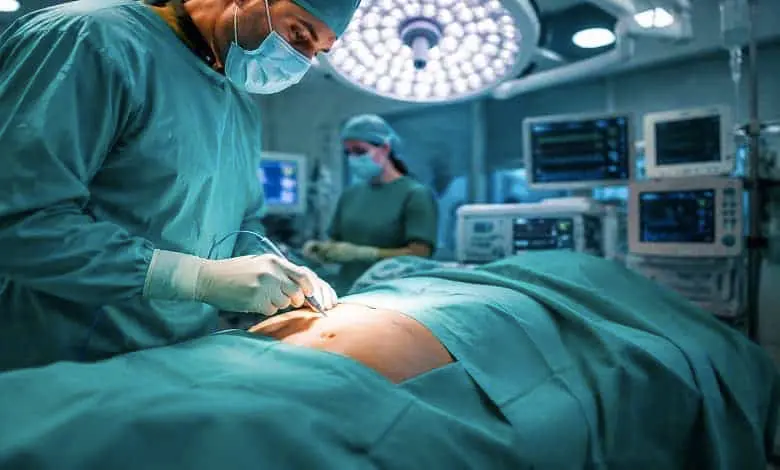 هنگام انتخاب جراح ابدومینوپلاستی به چه نکاتی توجه کنیم؟
