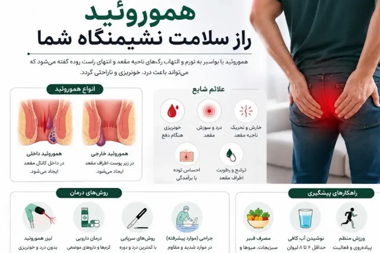 بواسیر چیست پارماطب