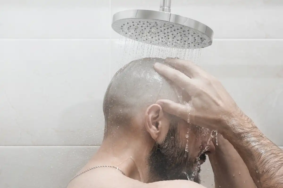 شامپو بعد از کاشت مو؛ نکات مهمی که باید بدانید