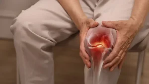 ۵ علائم اولیه آرتروز که نباید نادیده بگیرید