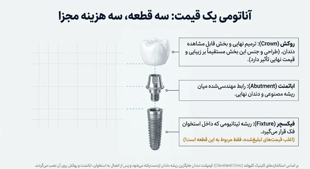 اجزای ایمپلنت دندان شامل فیکسچر، اباتمنت و روکش و تأثیر آن‌ها بر قیمت