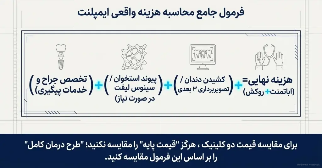 فرمول محاسبه هزینه واقعی ایمپلنت شامل روکش، جراحی، تصویربرداری و پیوند استخوان