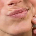 چه بیماری هایی باعث خشکی دهان میشود؟ ۵ بیماری جدی