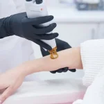 بررسی علت سفید شدن مو بعد از لیزر موهای زائد