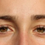 برای رشد مجدد ابروها چکار کنیم؟