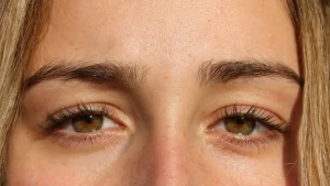 برای رشد مجدد ابروها چکار کنیم؟